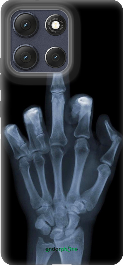 Силиконовый чехол Рука через рентген для Motorola Moto G86 - 1007u-4115 изображение 