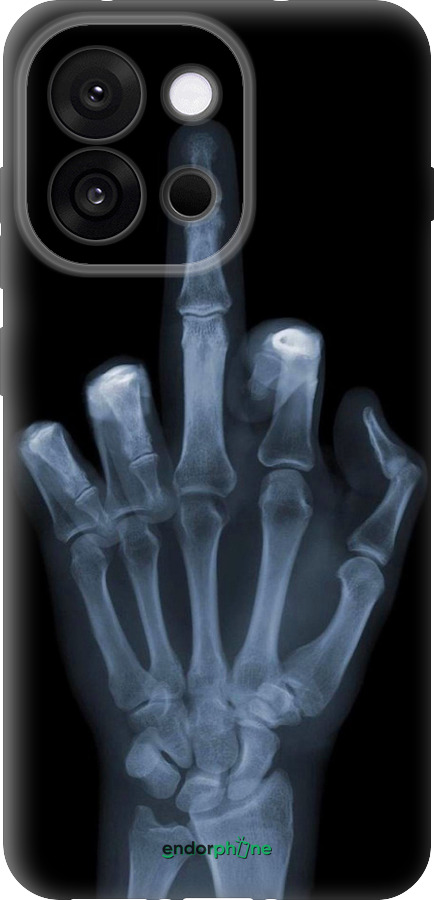 Силіконовий чехол Рука через рентген для OnePlus 13T 5G / 13S 5G - 1007u-4026 изображение 