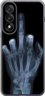 Силиконовый чехол Рука через рентген для OnePlus Nord 5 5G - 1007u-4133 изображение 