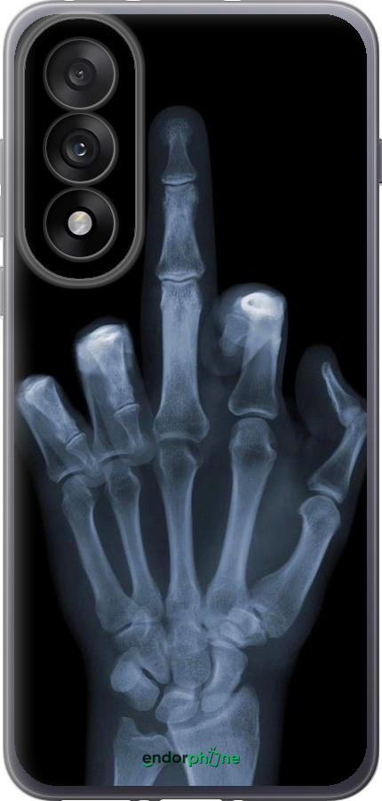 Силиконовый чехол Рука через рентген для OnePlus Nord 5 5G - 1007u-4133 изображение 