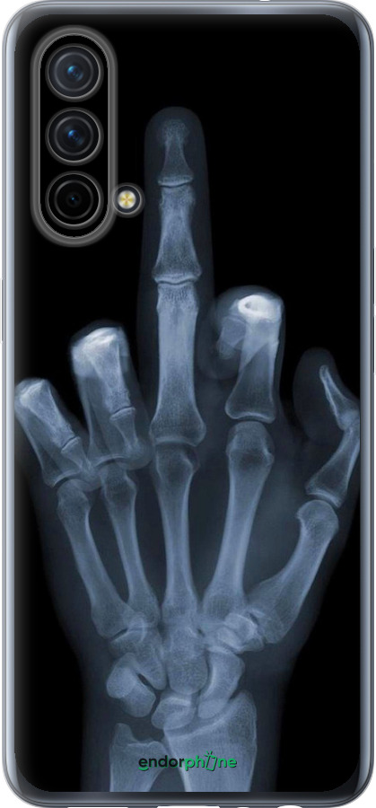 Силиконовый чехол Рука через рентген для OnePlus Nord CE 5G/CORE Edition 5G - 1007u-3484 изображение 