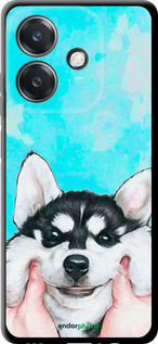 TPU чехол Улыбнись для Oppo A3X 4G/5G - 4276b-3815 изображение 