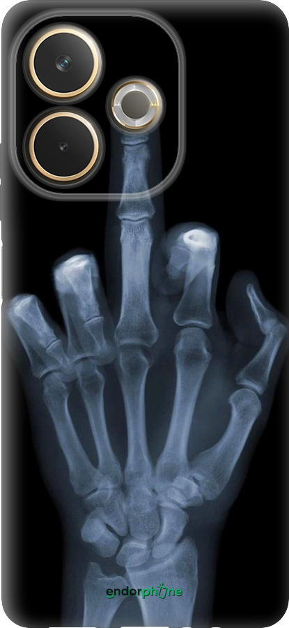 Силиконовый чехол Рука через рентген для Oppo A5 PRO - 1007u-3956 изображение 