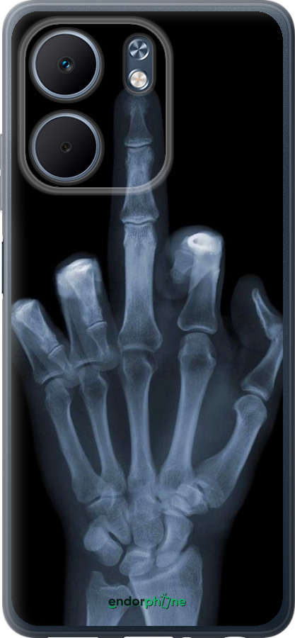 Силіконовий чехол Рука через рентген для Oppo A5X 4G/5G - 1007u-4090 изображение 
