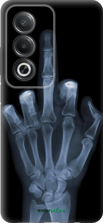 Силіконовий чехол Рука через рентген для Oppo A3 Pro 5G - 1007u-4144 изображение 
