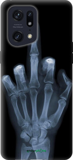 Силиконовый чехол Рука через рентген для Oppo Find X5 Pro - 1007u-2603 изображение 
