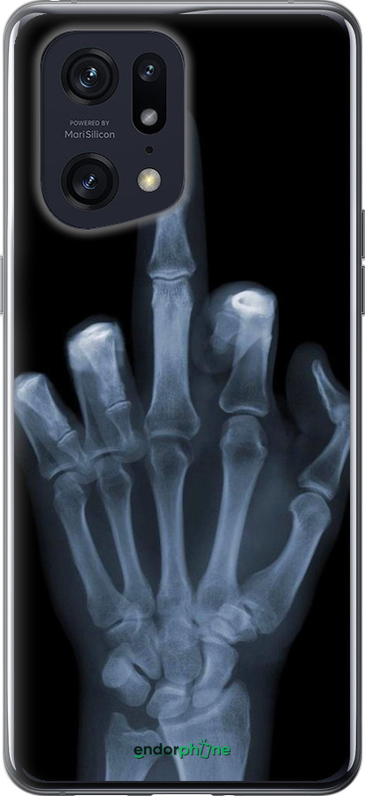Силиконовый чехол Рука через рентген для Oppo Find X5 Pro - 1007u-2603 изображение 