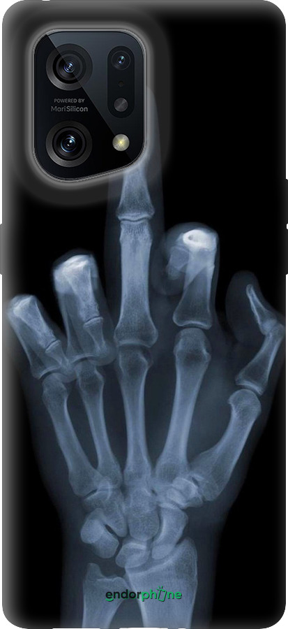 Силіконовий чехол Рука через рентген для Oppo Find X5 - 1007u-2602 изображение 