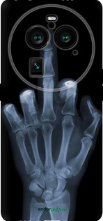 Силіконовий чехол Рука через рентген для Oppo Find X6 Pro - 1007u-3041 изображение 