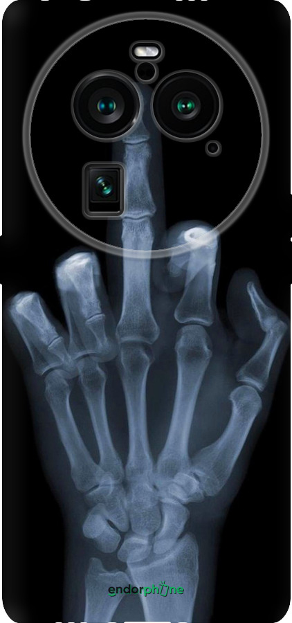 Силіконовий чехол Рука через рентген для Oppo Find X6 Pro - 1007u-3041 изображение 