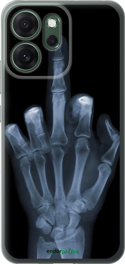 Силіконовий чехол Рука через рентген для Oppo RENO 14F 5G - 1007u-4091 изображение 