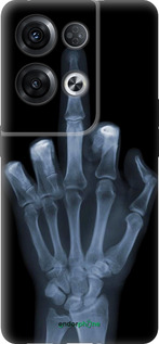 Силиконовый чехол Рука через рентген для Oppo Reno8 Pro 5G - 1007u-2615 изображение 