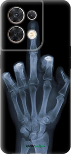 Силіконовий чехол Рука через рентген для Oppo Reno8 5G - 1007u-2614 изображение 