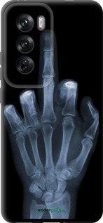 TPU чехол Рука через рентген для Oppo Reno12 Pro 5G - 1007b-3740 изображение 