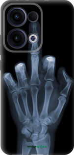 Силіконовий чехол Рука через рентген для Oppo Reno13 5G - 1007u-3944 изображение 