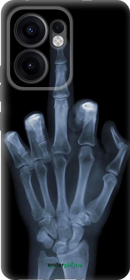 Силіконовий чехол Рука через рентген для Oppo Reno13 F 5G / Reno13 F 4G - 1007u-3955 изображение 