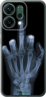 Силіконовий чехол Рука через рентген для Oppo RENO14 5G - 1007u-4058 изображение 