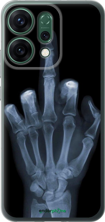 Силіконовий чехол Рука через рентген для Oppo RENO14 5G - 1007u-4058 изображение 