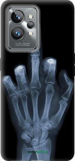 Силіконовий чехол Рука через рентген для Realme GT2 Pro - 1007u-2566 изображение 