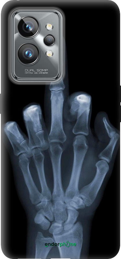 Силіконовий чехол Рука через рентген для Realme GT2 Pro - 1007u-2566 изображение 