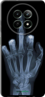 TPU чехол Рука через рентген для Realme Realme 12 5G - 1007b-3705 изображение 