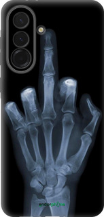 Силиконовый чехол Рука через рентген для Samsung Galaxy A36 - 1007u-3836 изображение 