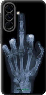 TPU чехол Рука через рентген для Samsung Galaxy A56 - 1007b-3882 изображение 