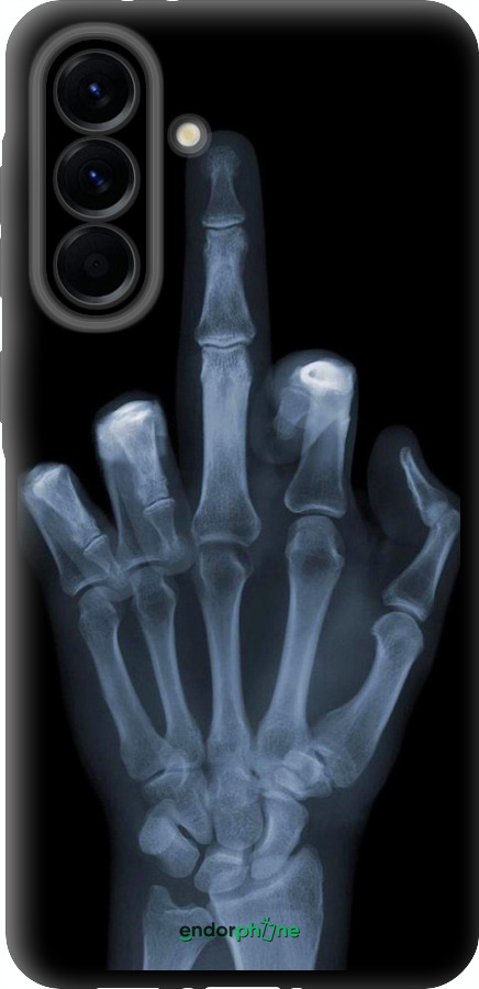 TPU чехол Рука через рентген для Samsung Galaxy A56 - 1007b-3882 изображение 