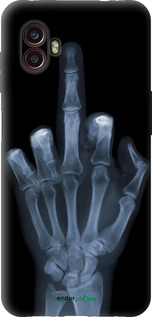 Силіконовий чехол Рука через рентген для Samsung Galaxy Xcover 6 Pro - 1007u-2918 изображение 