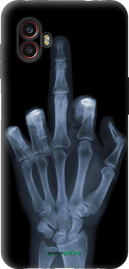 Силіконовий чехол Рука через рентген для Samsung Galaxy Xcover 6 Pro - 1007u-2918 изображение 