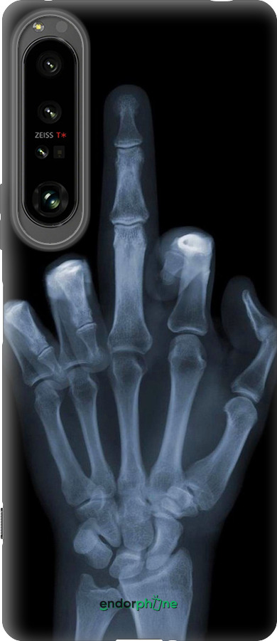 Силиконовый чехол Рука через рентген для Sony Xperia 1 IV - 1007u-2787 изображение 