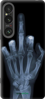 Силиконовый чехол Рука через рентген для Sony Xperia 1 VI - 1007u-3975 изображение 
