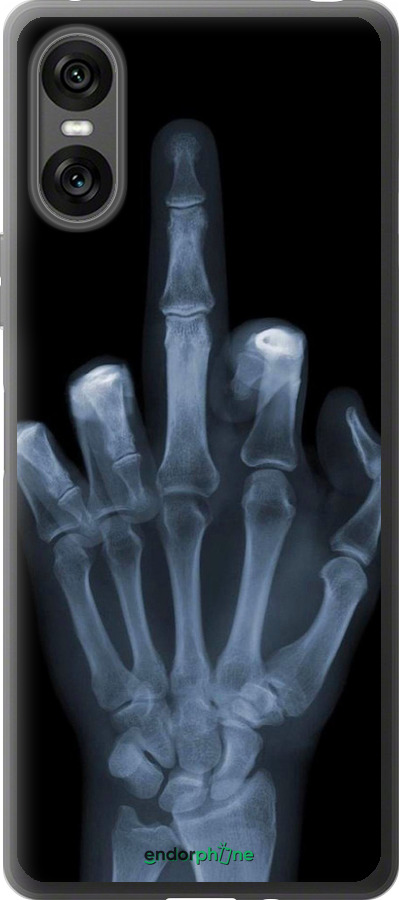 Силиконовый чехол Рука через рентген для Sony Xperia 10 VI - 1007u-3976 изображение 