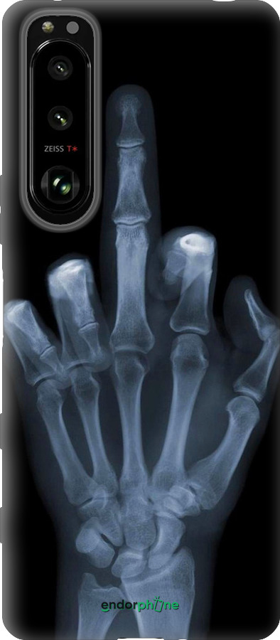 Силиконовый чехол Рука через рентген для Sony Xperia 5 III - 1007u-2580 изображение 