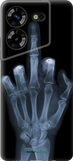 Силіконовий чехол Рука через рентген для Tecno Pova 5 - 1007u-3139 изображение 