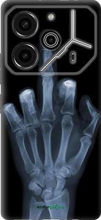 Силіконовий чехол Рука через рентген для Tecno Pova 6 Pro - 1007u-3689 изображение 