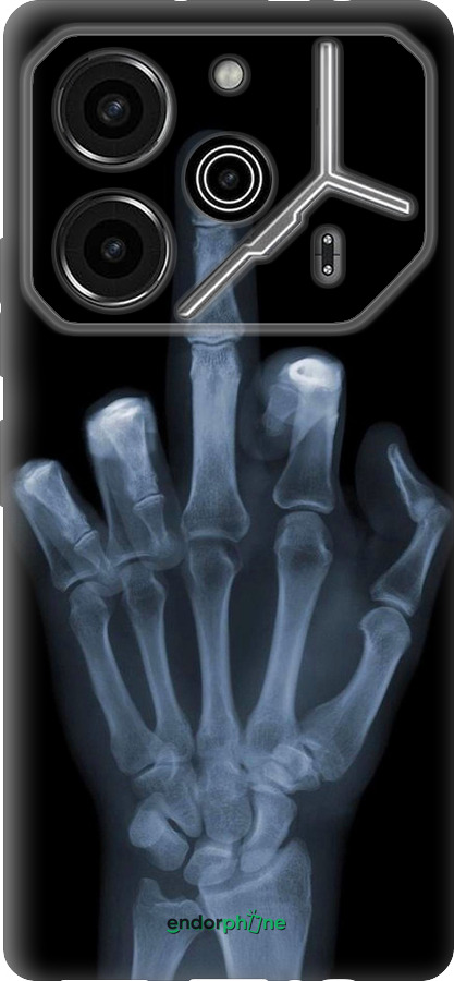 Силіконовий чехол Рука через рентген для Tecno Pova 6 Pro - 1007u-3689 изображение 