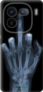 Силиконовый чехол Рука через рентген для Vivo IQOO 12 PRO - 1007u-3420 изображение 