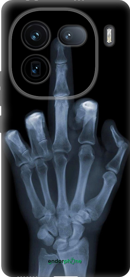 Силиконовый чехол Рука через рентген для Vivo iQOO 12 - 1007u-3433 изображение 