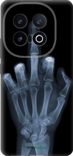 Силиконовый чехол Рука через рентген для Vivo IQOO 13 - 1007u-3913 изображение 