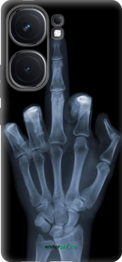 Силиконовый чехол Рука через рентген для Vivo iQOO Neo9 - 1007u-3631 изображение 