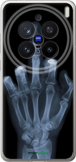 Силиконовый чехол Рука через рентген для Vivo X200 PRO - 1007u-3883 изображение 