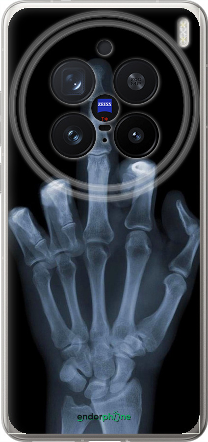 Силиконовый чехол Рука через рентген для Vivo X200 PRO - 1007u-3883 изображение 