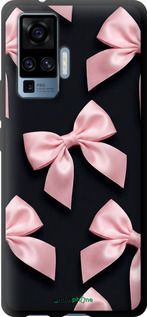 TPU чехол Coquette Ribbons Dark Coquette для Vivo X50 Pro - 6767b-1956 изображение 