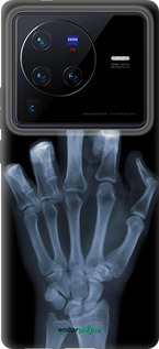 Силиконовый чехол Рука через рентген для Vivo X80 Pro - 1007u-2630 изображение 