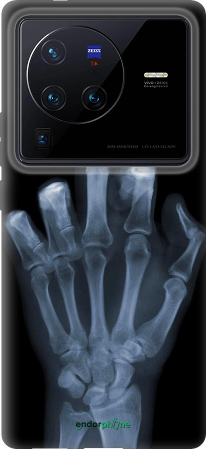 Силиконовый чехол Рука через рентген для Vivo X80 Pro - 1007u-2630 изображение 