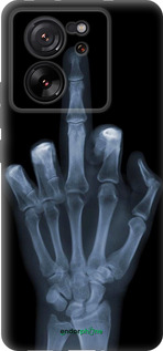 Силіконовий чехол Рука через рентген для Xiaomi 13T PRO - 1007u-3810 изображение 