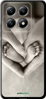 TPU чехол Любов для Xiaomi 14T 5G - 699b-3773 изображение 