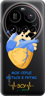 Силиконовый чехол Сердце v2 для Xiaomi 15 Ultra - 5296u-3967 изображение 