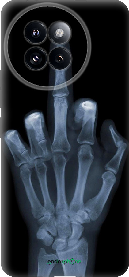 Силиконовый чехол Рука через рентген для Xiaomi Civi 4 Pro - 1007u-3682 изображение 